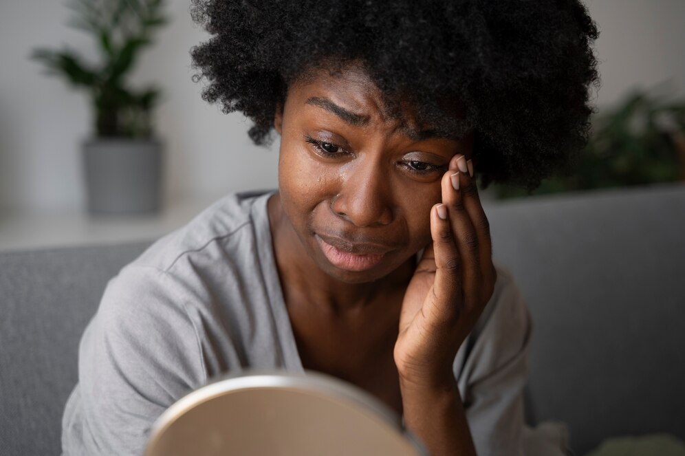 Buy the original How to Treat Skin Rashes in Ibadan in Ibadan Nigeria