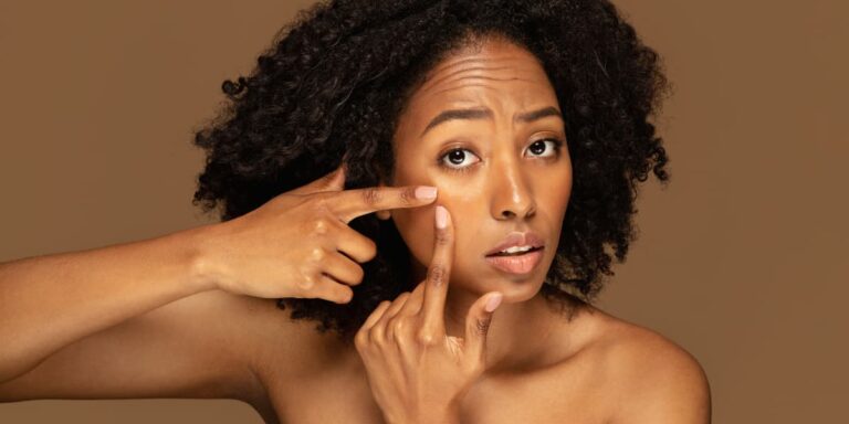 Buy the original How to Get Rid of Textured Skin: The Right Approach for Real, Lasting Results in Ibadan Nigeria